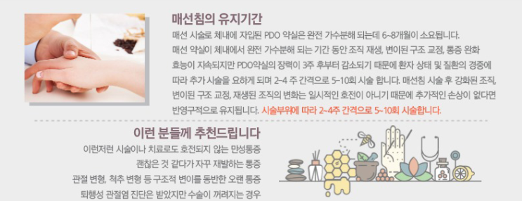  반영구적인 비수술요법 통증매선, 매선침