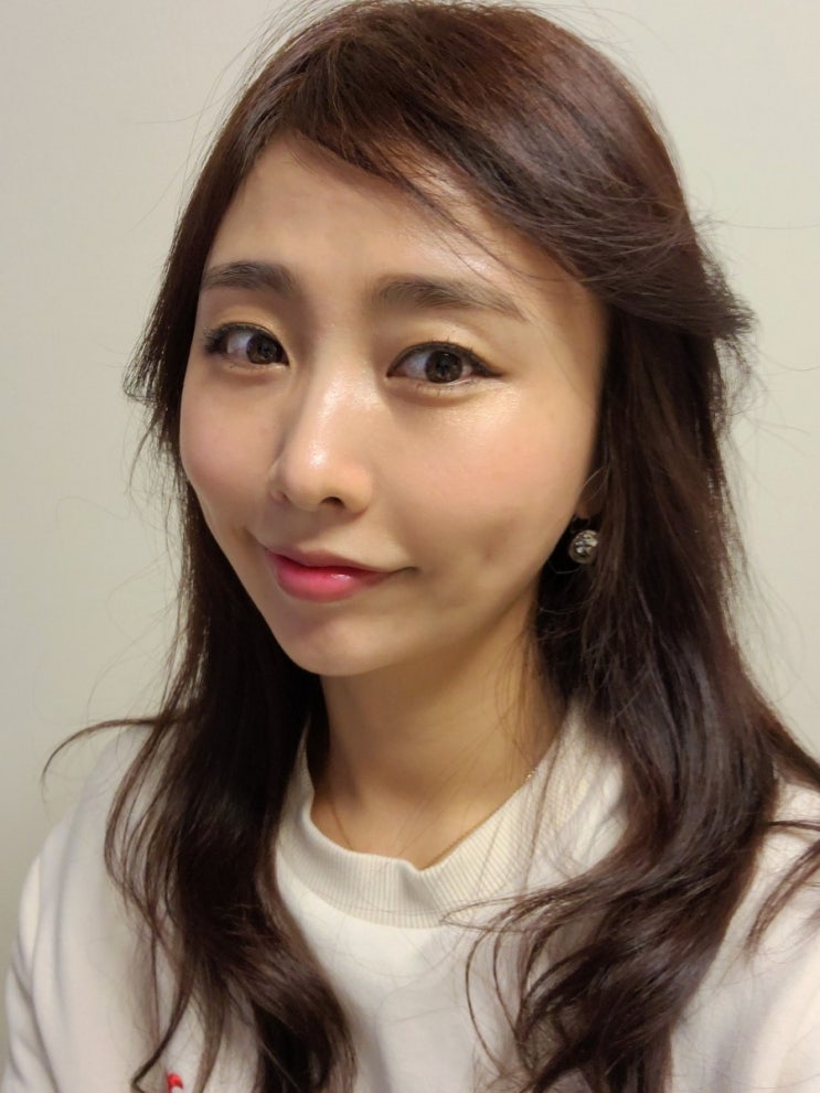  선릉역 피부과 클라리티 레이저 & 헬리오스 토닝 색소 치료 후기