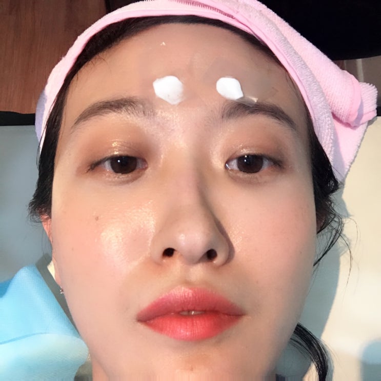  수두 자국 패인 흉터 새살침 내돈내산 후기