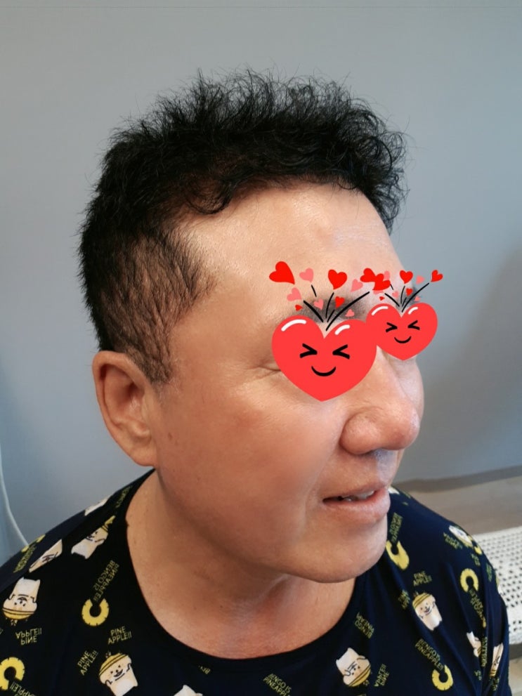  각질제거 필링으로 맑고 햐얀피부 관리하세요
