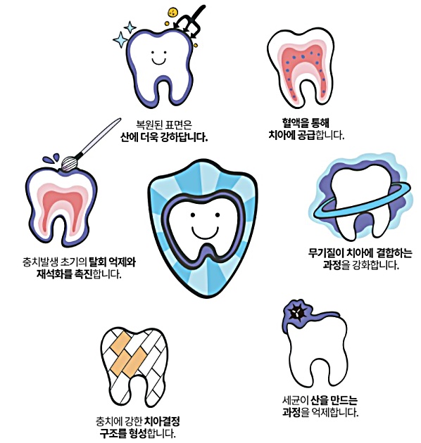 부산 당감동 감동치과 어린이 불소도포 주의사항