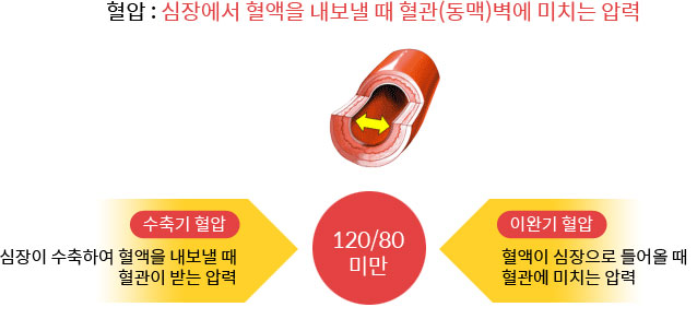 고혈압 원인과 예방｜관리는 어떻게?