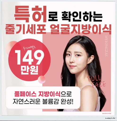  줄기세포 얼굴지방이식 붓기 알려드릴게요
