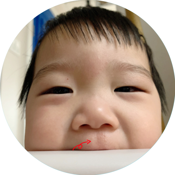  아쿠아퍼 수딩 오인트먼트로 아기 침독 방어하기!