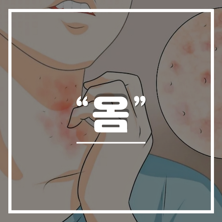  ‘피부 전염병’ 옴 증상 및 원인과 치료법 : 예방을 위한 필수 생활 수칙