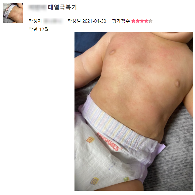 아기피부관리 태열 연고사용 전에 꼭 보습부터 제대로