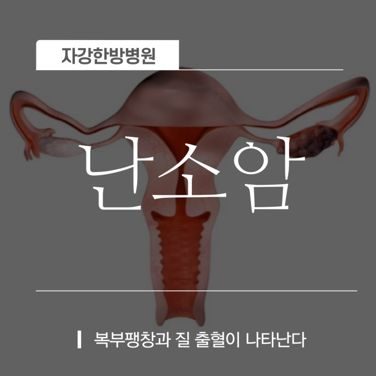  안양 난소암 초기 증상 및 원인 생존율 검사방법 좋은음식이란?
