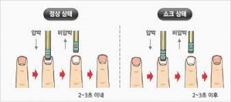 성인간호학 쇼크shock환자 원인종류증상 치료간호중재 출혈성 신경성 아나필락시스 성인간호학 쇼크shock환자 원인종류증상 치료간호중재 출혈성 신경성 아나필락시스