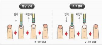 성인간호학 쇼크shock환자 원인종류증상 치료간호중재 출혈성 신경성 아나필락시스