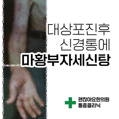 대상포진 후 신경통에 마황부자세신탕. 냉증과 통증 [한방스퀘어 : 통증의 한방치료 1]