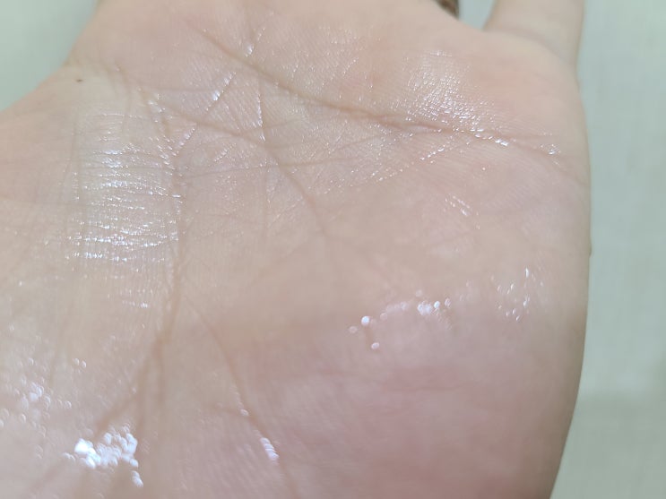  머리에서 땀이 많이 나요 두한증