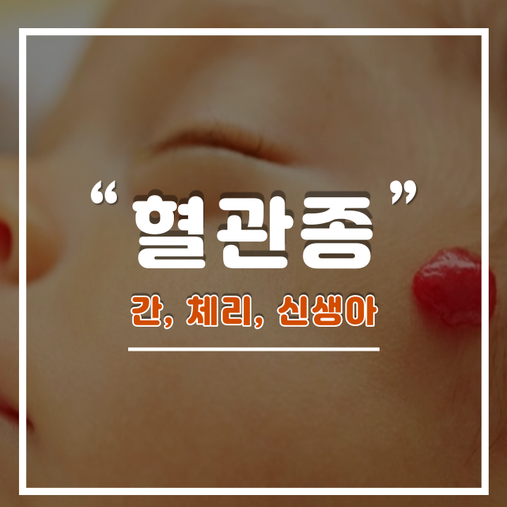  혈관종 증상 및 원인과 치료 방법 : 간, 체리, 신생아