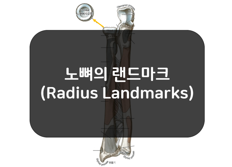 노뼈의 랜드마크(Radius Landmarks)!!
