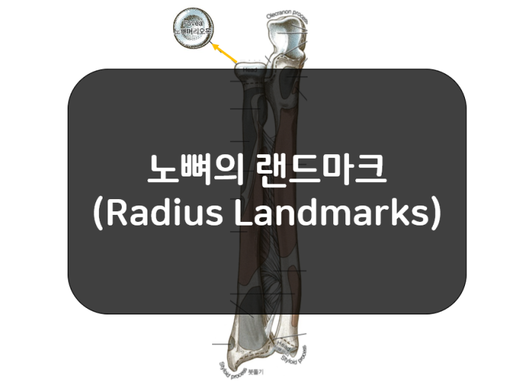  노뼈의 랜드마크(Radius Landmarks)!!