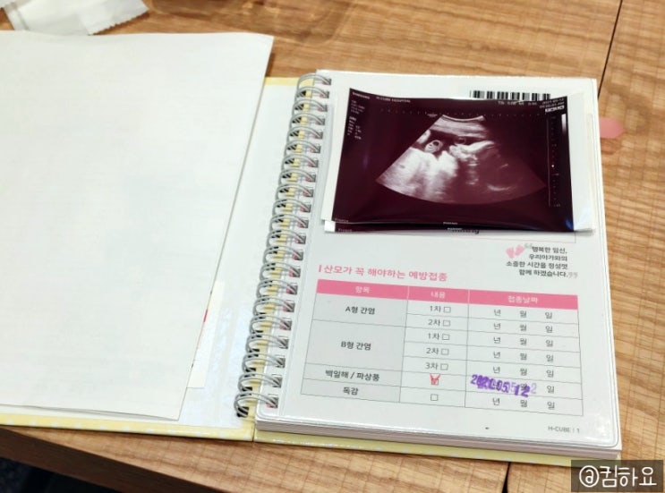  [킴하요의 임신일기] 임신30주차 백일해주사 접종했어요