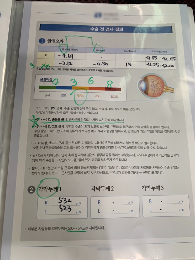  서울 시력교정술 라섹  병원 두군데 검안 후기 및 수술 feat 쫄보