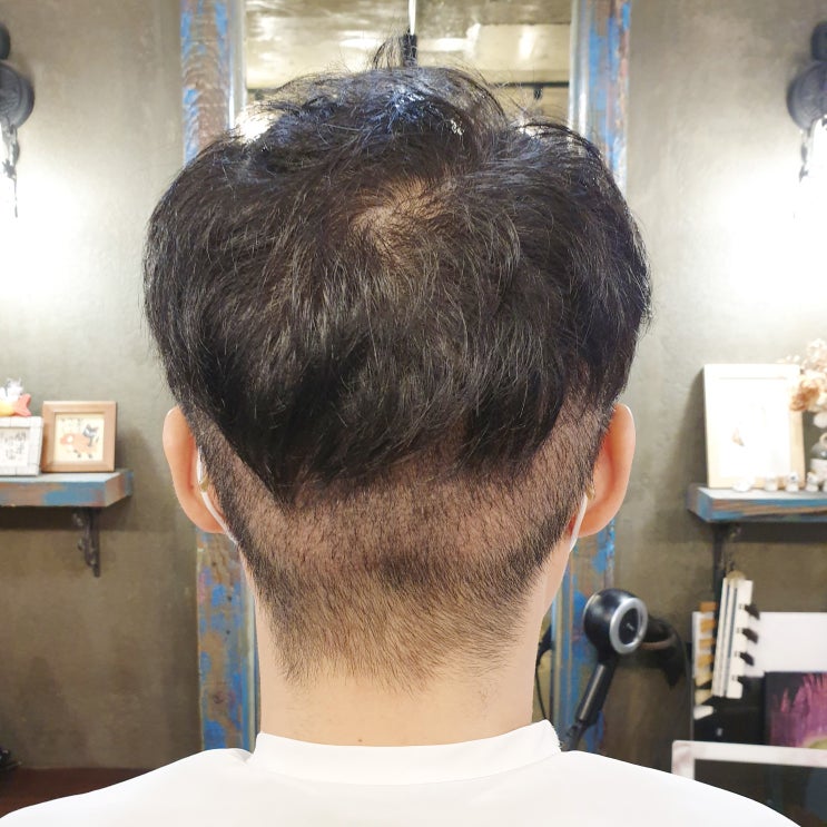  m자 이마 헤어스타일 고민 해결