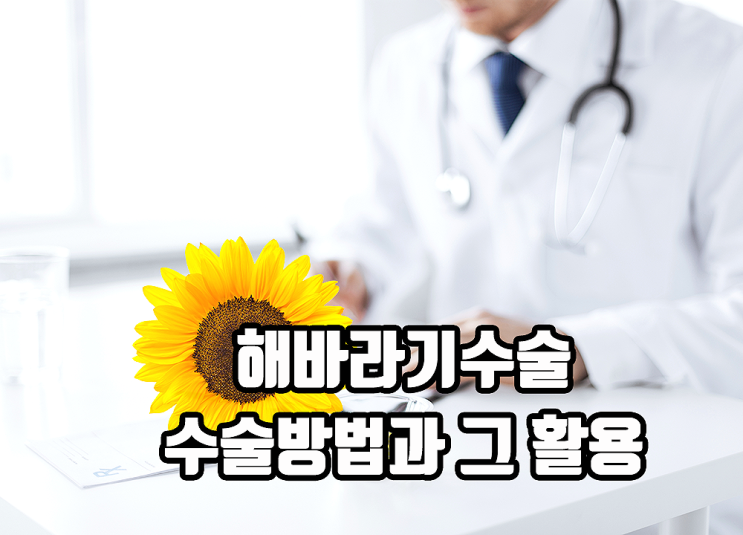 해바라기수술, 수술 방법과 그 활용도는? 해바라기수술, 수술 방법과 그 활용도는?