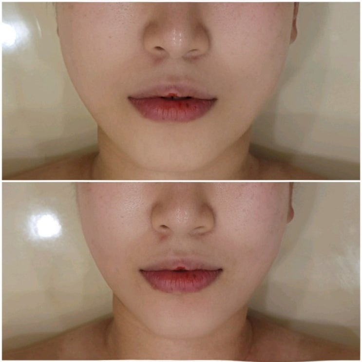  광주 우산동 피부관리 연에스테틱 윤곽관리