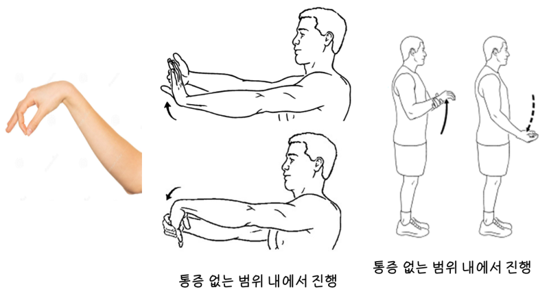 원위 요골 골절 수술 후 단계, 주차별 재활운동 - Distal radius fracture surgery ...
