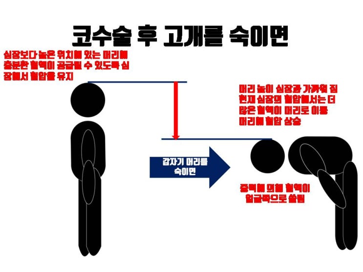  머리가 떡져도 코수술 후 1주 정도는 고개 숙이고 머리감지 마세요. 심한 코수술 후 출혈 생길 수 있어요.