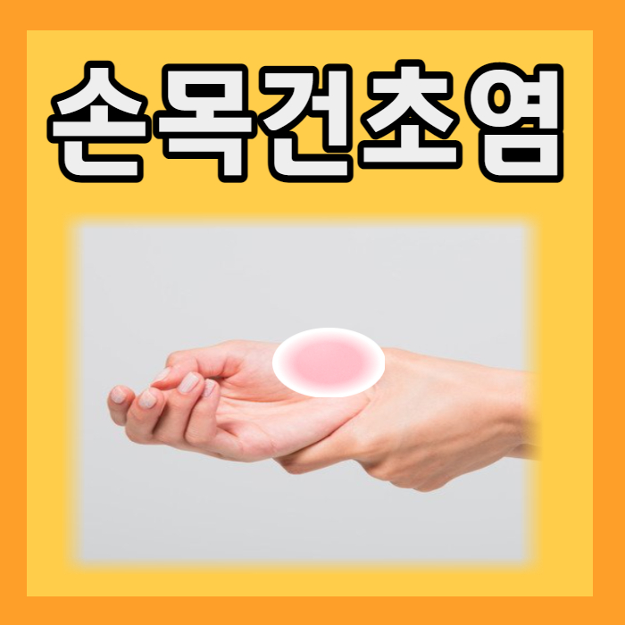  손목건초염 손목터널증후군 차이점 증상 수술 치료 보호대 예방 마사지 스트레칭
