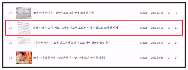  갑상선기능저하증 한약 만으로 치료가 가능할까?