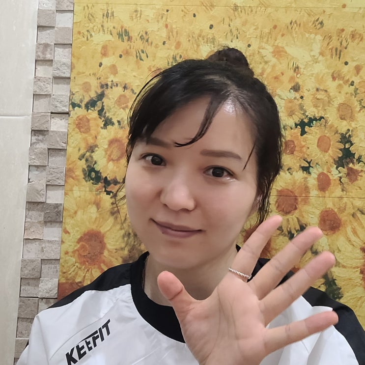  세미아웃라인디자인 자연유착 눈매교정 앞트임 쌍꺼풀수술 일주일 실밥 제거