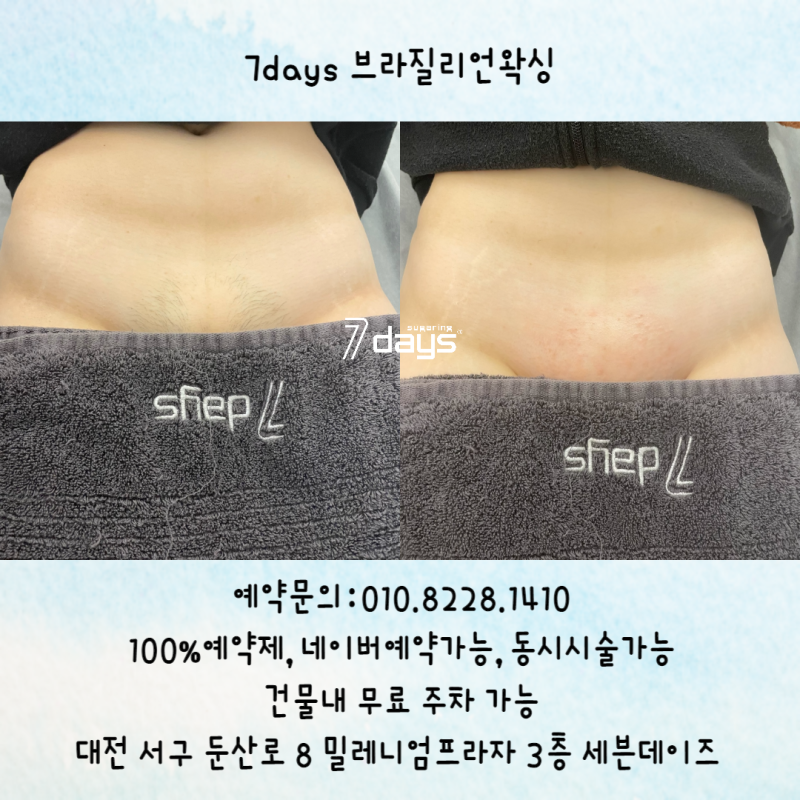 대전 브라질리언왁스: 둔산동 레드뷰티왁스