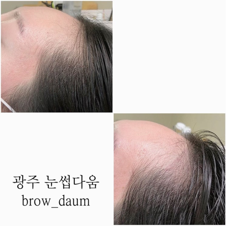  광주 헤어라인문신 후기 자연스럽게 이마라인 정리 완료