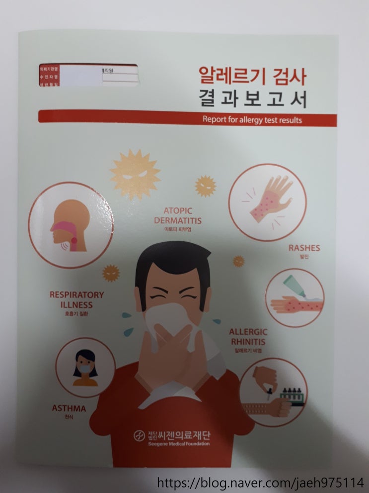  알레르기검사와 비용 직접 받은 경험담
