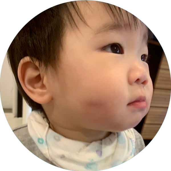  아기멍 없애려면 이것은 꼭 챙기세요