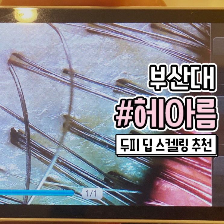  부산대 미용실 헤아름 2nd에서 받은 두피관리