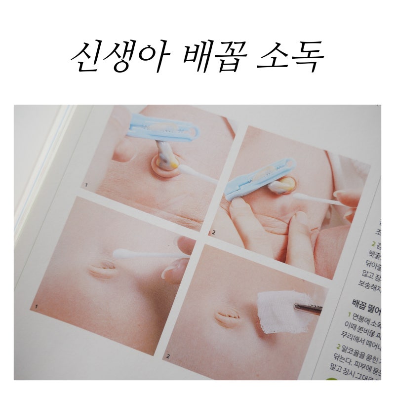 신생아 배꼽탈장 치료방법 배꼽피소독방법 육육종