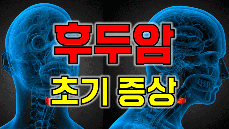  "혹시 후두암 아닌가요?" 무시하기 쉬운 후두암 초기증상 5가지