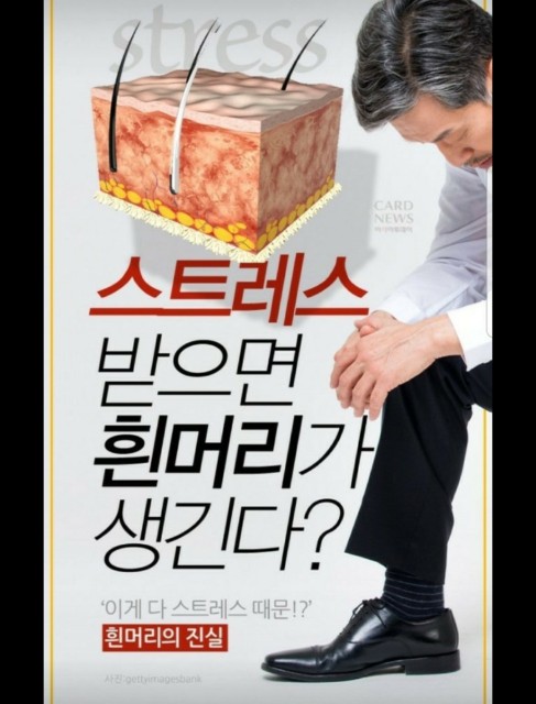  스트레스와 흰머리는 관련이 있을까??