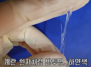  노란냉? 초록냉? 갈색냉? 질 분비물 색깔로 알아보는 건강 상태