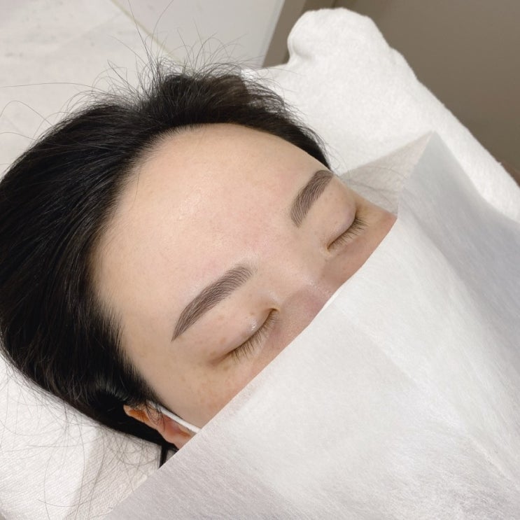  수원 에스테틱 인스타 방문 붉은 잔색 세미 일자로