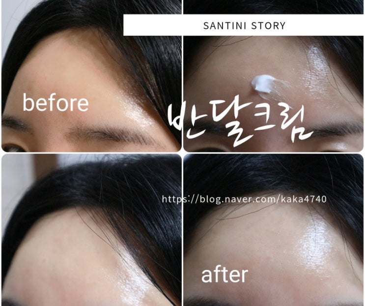이마잔주름 없애기 하프문 반달크림으로 이마볼륨감 살려본 후기! 이마잔주름 없애기 하프문 반달크림으로 이마볼륨감 살려본 후기!