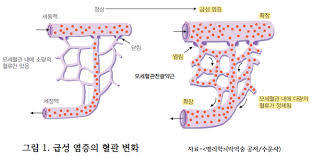 성인간호학 염증반응이란 백혈구기능역할 자연능동수동면역 T림프구 자연살해세포