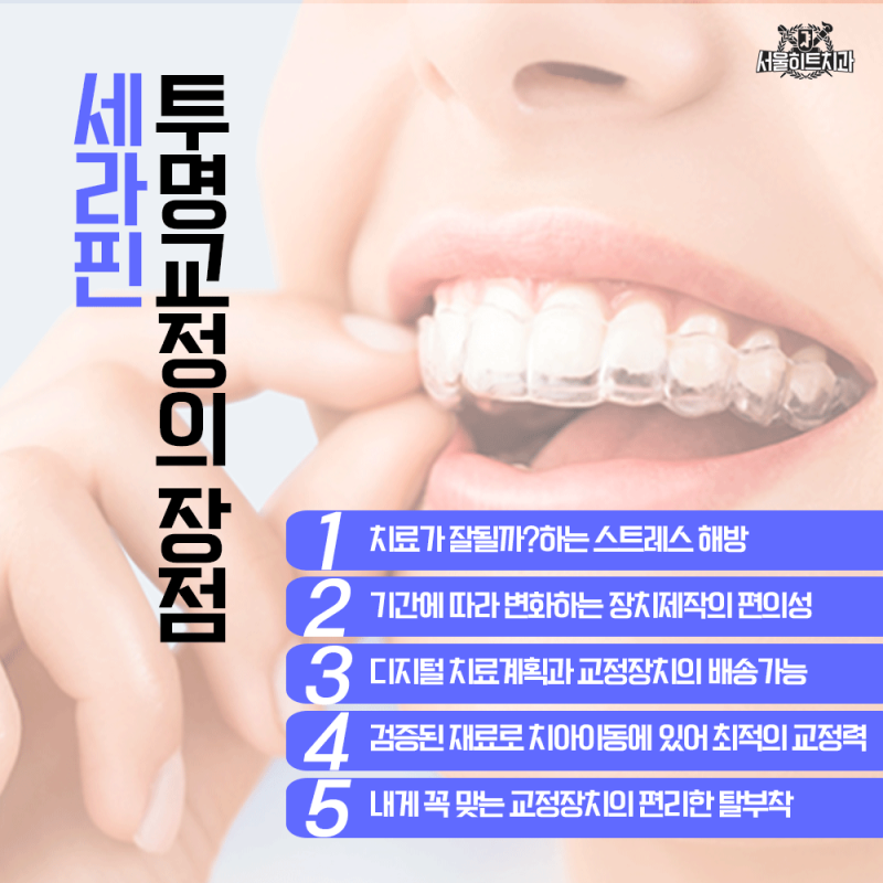 [D슬치생활] 세라핀 투명교정 이런 분들에게 필요해요! 10