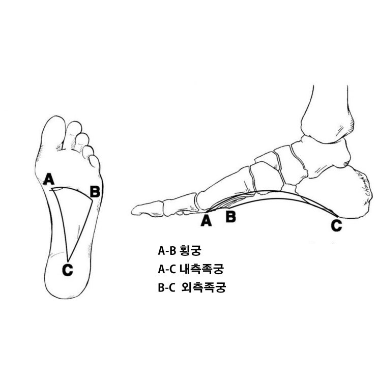  몸을 지탱하는 족궁(아치)의 기능이 약해지면