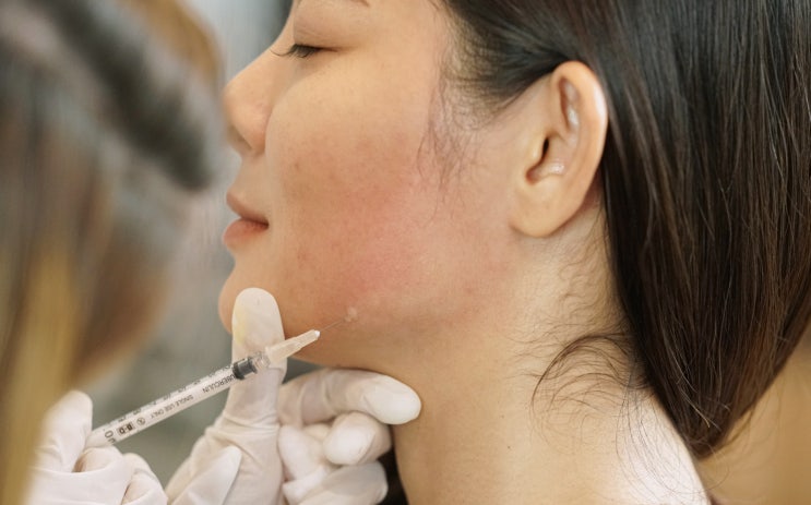  광주 사각턱 보톡스, 잘하는 곳 찾을 수 있을까?