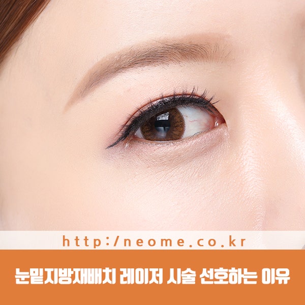대구 눈밑 지방 재배치 레이저 사용이 핵심