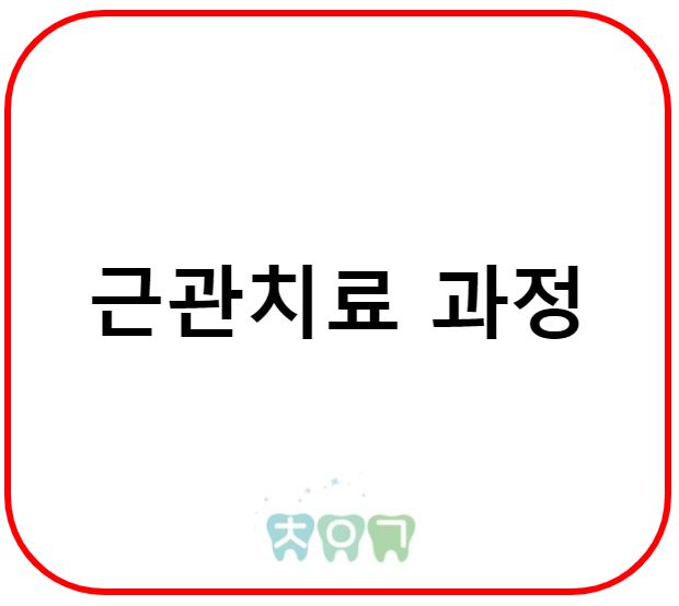  치아 신경치료 과정 알아보기. (정확한 표현은 근관치료가 맞습니다)