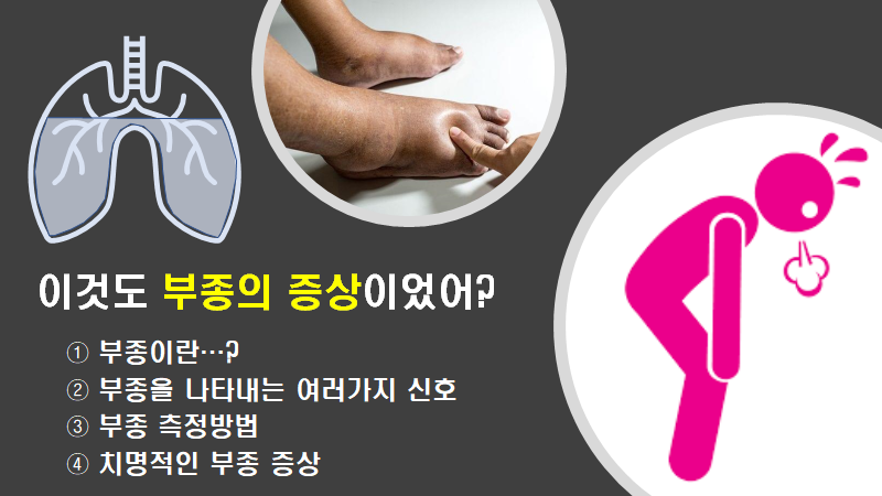 부종의 정의 : 부종 측정방법 : 치명적인 부종 증상 : 네이버 블로그
