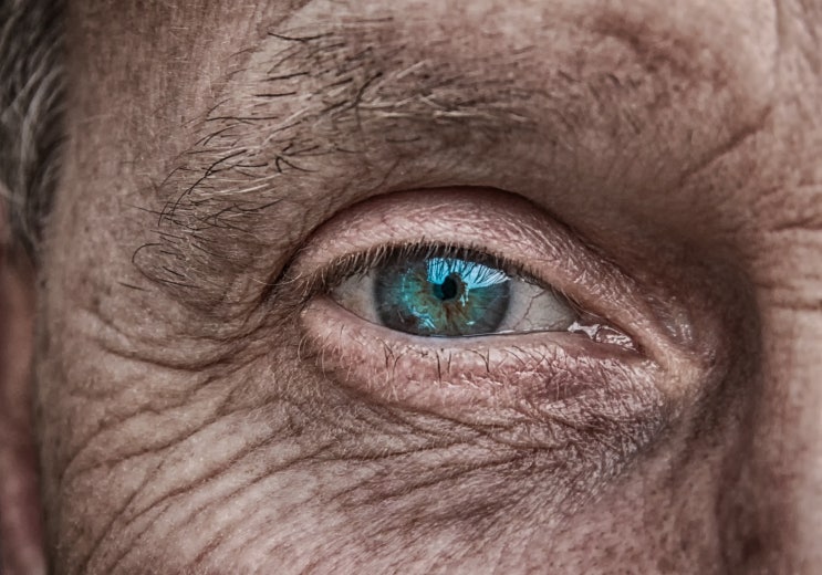 광유전자 치료 후 시각장애 환자의 시력 일부 회복