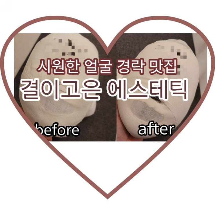  분당 피부샵 정자동 마사지 결이고은 에스테틱 에서 시원한 얼굴경락 받고왔어요