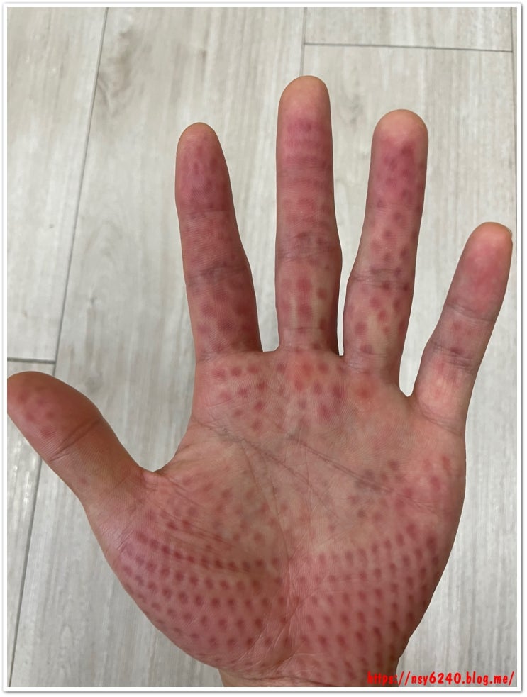  메디니스 핸드테라피 마사지기 MD-5602 6개월 사용 후기