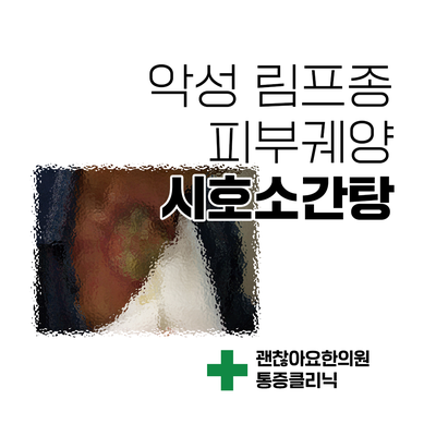 악성 림프종으로 인한 피부궤양. 알아두면 좋은 시호소간탕의 진통효과 [한방스퀘어 : 통증의 한방치료 4] ④